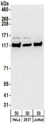 Western Blot: Kinesin 5B Antibody [NBP2-32279]