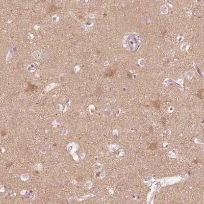 Immunohistochemistry-Paraffin: Kinesin 5C Antibody [NBP1-87429]