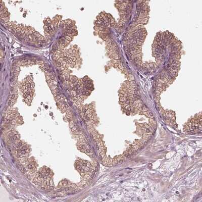 Immunohistochemistry-Paraffin: Kinesin 5C Antibody [NBP1-87429]