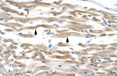 Immunohistochemistry-Paraffin: Kinesin C2 Antibody [NBP1-58247]