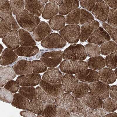 Immunohistochemistry-Paraffin: Kinesin C2 Antibody [NBP1-87535]
