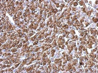 Immunohistochemistry-Paraffin: Kinesin C2 Antibody [NBP2-17061]
