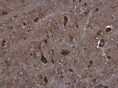 Immunohistochemistry-Paraffin: Kinesin C2 Antibody [NBP2-17061]