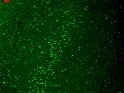 Immunohistochemistry: Kir2.1 Antibody (S112) [NBP2-12900]