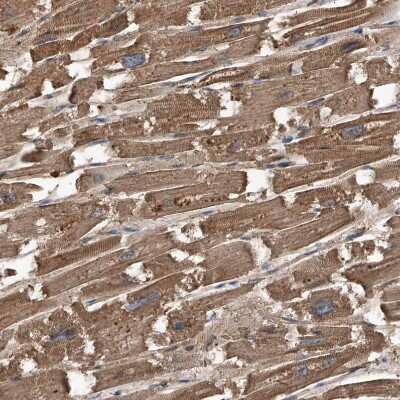 Immunohistochemistry-Paraffin: Kir2.1 Antibody [NBP1-87709]