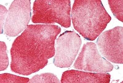 Immunohistochemistry-Paraffin: Kir2.2 Antibody [NBP2-87693]