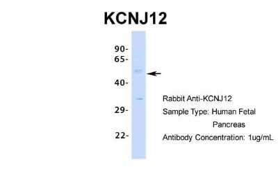 Western Blot: Kir2.2 Antibody [NBP2-87693]