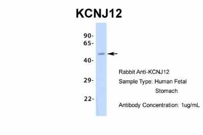Western Blot: Kir2.2 Antibody [NBP2-87693]