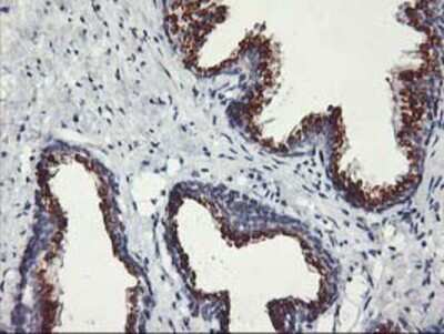 Immunohistochemistry-Paraffin: Kir3.1 Antibody (OTI1G3) [NBP2-01702]