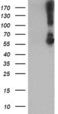 Western Blot: Kir3.1 Antibody (OTI1G3)Azide and BSA Free [NBP2-71065]