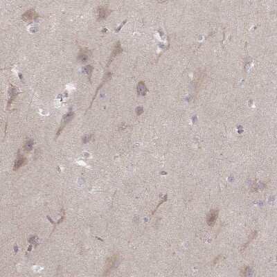 Immunohistochemistry-Paraffin: Kir3.3 Antibody [NBP2-57515]