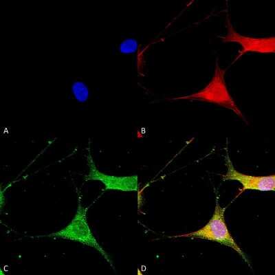 Immunocytochemistry/ Immunofluorescence: Kir6.1 Antibody (S366-60) [NBP2-59324]