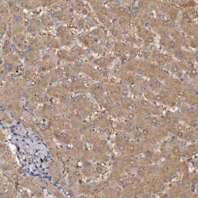 Immunohistochemistry-Paraffin: Kir6.1 Antibody [NBP1-87710]
