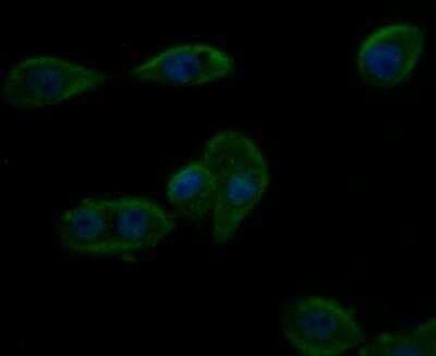 Immunocytochemistry/ Immunofluorescence: Kir6.2 Antibody [NBP2-76944]