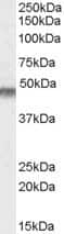 Western Blot: Kir6.2 Antibody [NBP1-00206]