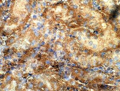 Immunohistochemistry-Paraffin: Kirrel1/NEPH1 Antibody [NBP3-12277]