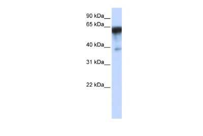 Western Blot: Kirrel1/NEPH1 Antibody [NBP1-91309]
