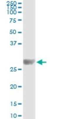 Immunoprecipitation: Kirrel2/NEPH3 Antibody (2B9-1D3) [H00084063-M01]