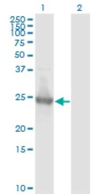 Western Blot: Kirrel2/NEPH3 Antibody (2B9-1D3) [H00084063-M01]