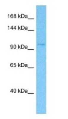 Western Blot: Klotho beta Antibody [NBP3-09315]