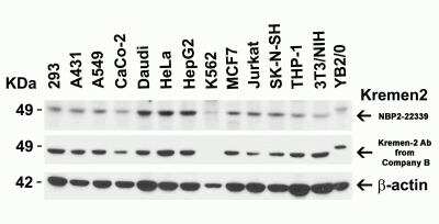 Western Blot: Kremen-2 AntibodyBSA Free [NBP2-22339]