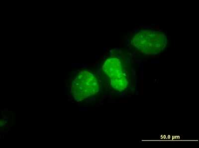 Immunocytochemistry/ Immunofluorescence: Ku70/XRCC6 Antibody (3D12) [H00002547-M05]