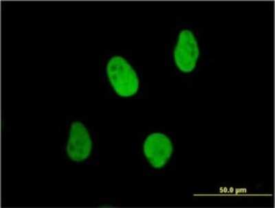 Immunocytochemistry/ Immunofluorescence: Ku70/XRCC6 Antibody (4C2-1A6) [H00002547-M01]