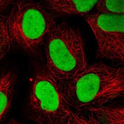 Immunocytochemistry/ Immunofluorescence: Ku70/XRCC6 Antibody [NBP2-38567]