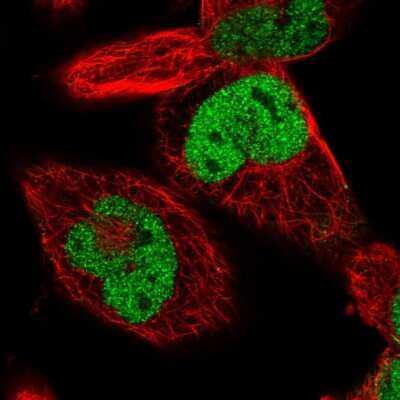Immunocytochemistry/ Immunofluorescence: Ku70/XRCC6 Antibody [NBP2-38954]