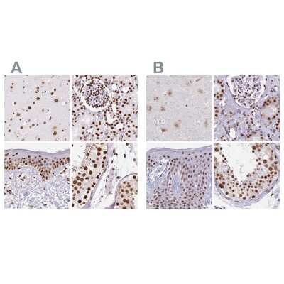 Immunohistochemistry-Paraffin: Ku70/XRCC6 Antibody [NBP2-38567]