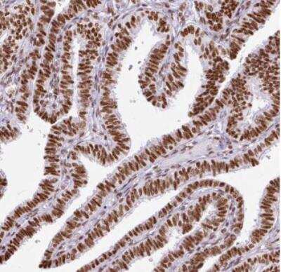 Immunohistochemistry-Paraffin: Ku70/XRCC6 Antibody [NBP2-38567]
