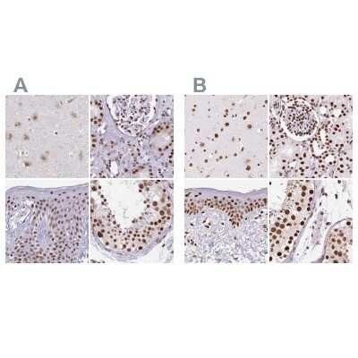 Immunohistochemistry-Paraffin: Ku70/XRCC6 Antibody [NBP2-38954]