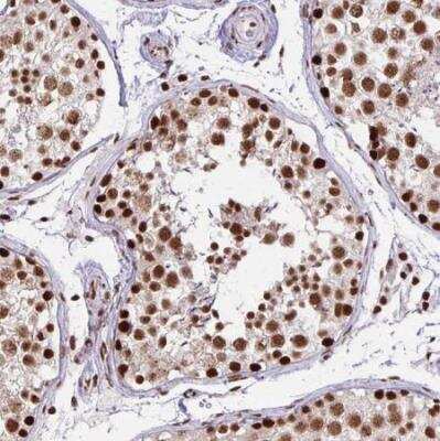 Immunohistochemistry-Paraffin: Ku70/XRCC6 Antibody [NBP2-38954]