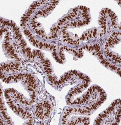 Immunohistochemistry-Paraffin: Ku70/XRCC6 Antibody [NBP2-38954]