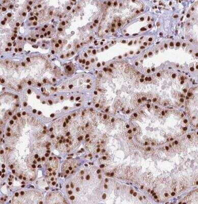 Immunohistochemistry-Paraffin: Ku70/XRCC6 Antibody [NBP2-38954]