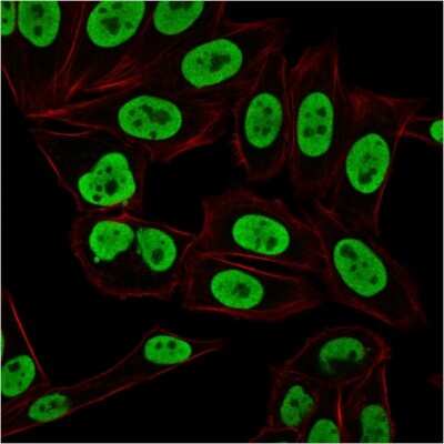 Immunocytochemistry/ Immunofluorescence: Ku70/XRCC6 Antibody (KU729) [NBP2-34247]