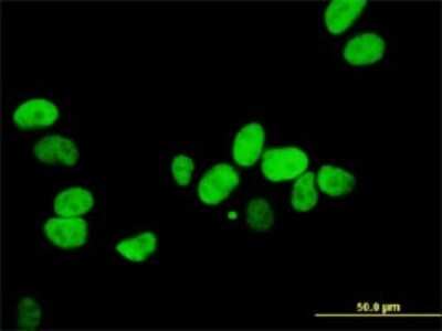 Immunocytochemistry/ Immunofluorescence: Ku80/XRCC5 Antibody (3D8) [H00007520-M02]