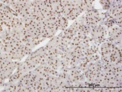 Immunohistochemistry-Paraffin: Ku80/XRCC5 Antibody (3D8) [H00007520-M02]