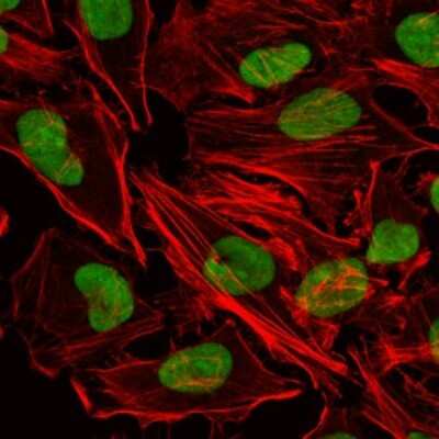 Immunocytochemistry/ Immunofluorescence: Ku80/XRCC5 Antibody (5C5) - BSA Free [NBP2-37583]