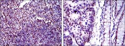Immunohistochemistry-Paraffin: Ku80/XRCC5 Antibody (5C5) - BSA Free [NBP2-37583]