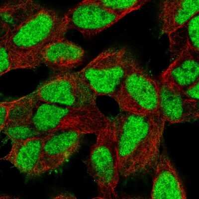 Immunocytochemistry/ Immunofluorescence: Ku80/XRCC5 Antibody [NBP2-55954]