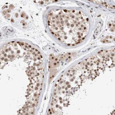 Immunohistochemistry-Paraffin: Ku80/XRCC5 Antibody [NBP1-87829]