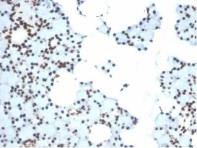 Immunohistochemistry-Paraffin: Ku80/XRCC5 Antibody (XRCC5/7315) [NBP3-13795]