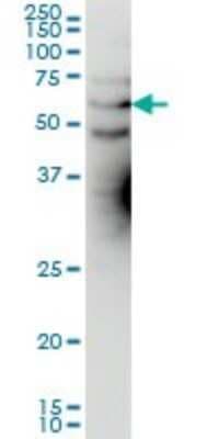 Western Blot: Kv1.3 Antibody (1D8) [H00003738-M01]