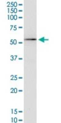 Western Blot: Kv1.3 Antibody (1D8) [H00003738-M01]