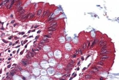 Immunohistochemistry-Paraffin: Kv1.3 Antibody [NBP3-14388]
