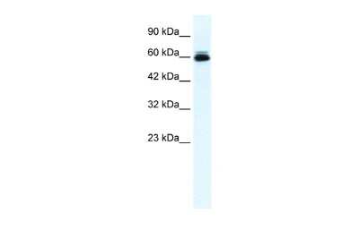 Western Blot: Kv10.2 Antibody [NBP2-83132]