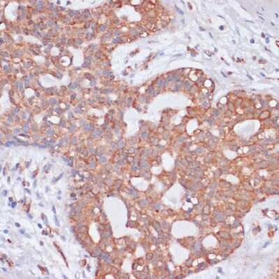 Immunohistochemistry-Paraffin: Kv11.1 Antibody - Azide and BSA Free [NBP3-03109]