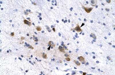 Immunohistochemistry: Kv11.2 Antibody [NBP2-84125]