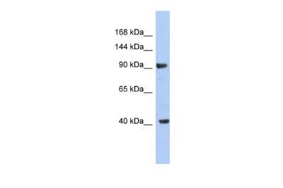 Western Blot: Kv11.2 Antibody [NBP2-84127]
